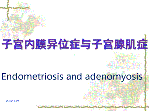 完成子宫内膜异位症课件.ppt