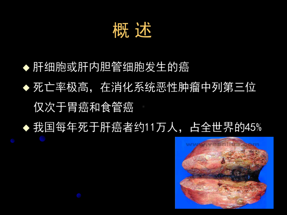 （内科学课件）原发性肝癌-共56页.ppt_第2页