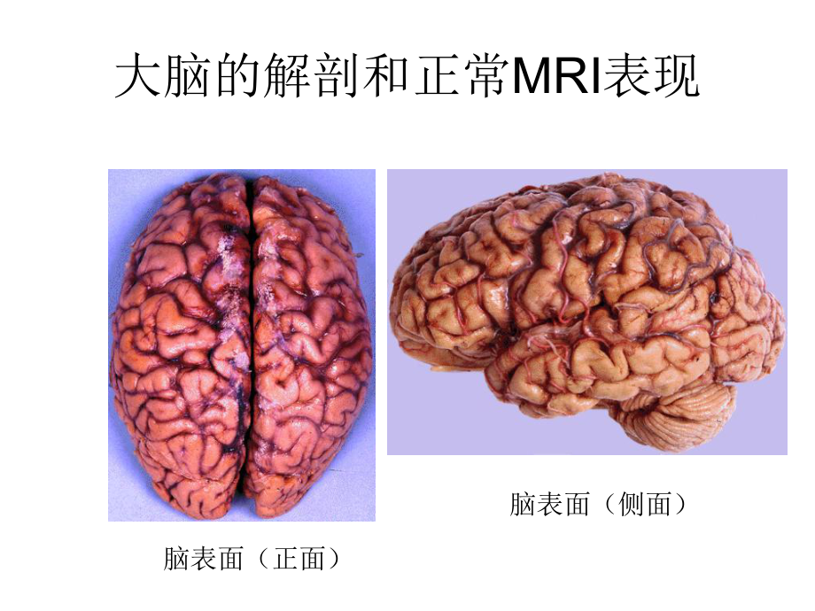 大脑的解剖和正常mri表现-ppt课件.ppt_第1页