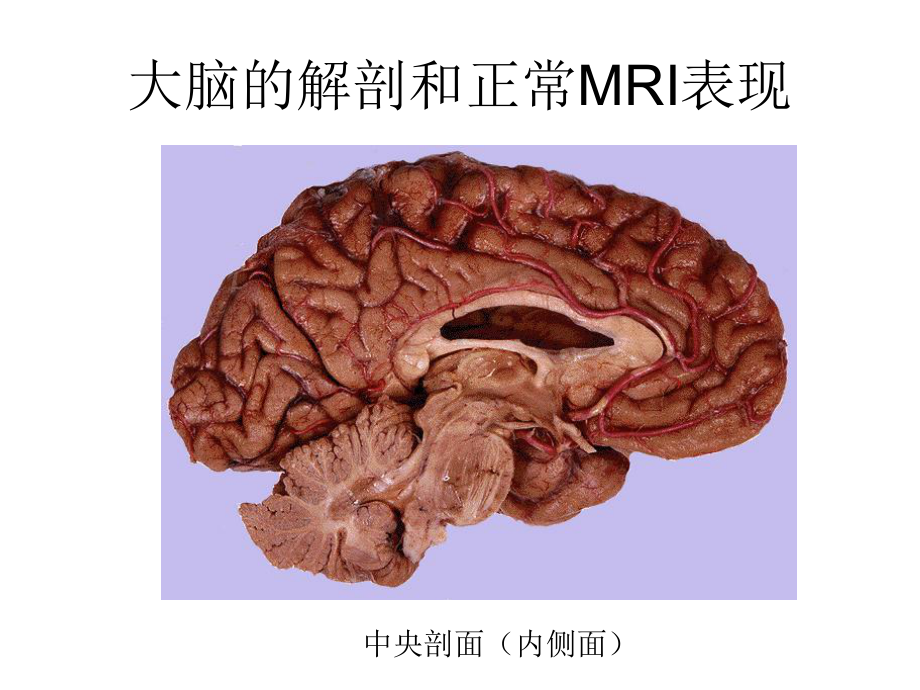 大脑的解剖和正常mri表现-ppt课件.ppt_第3页