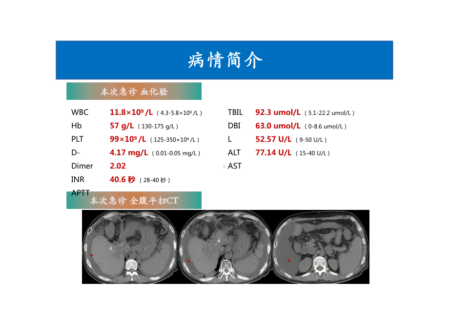 一例肝癌合并消化道出血患者的诊治经过及用药反思课件.ppt_第3页