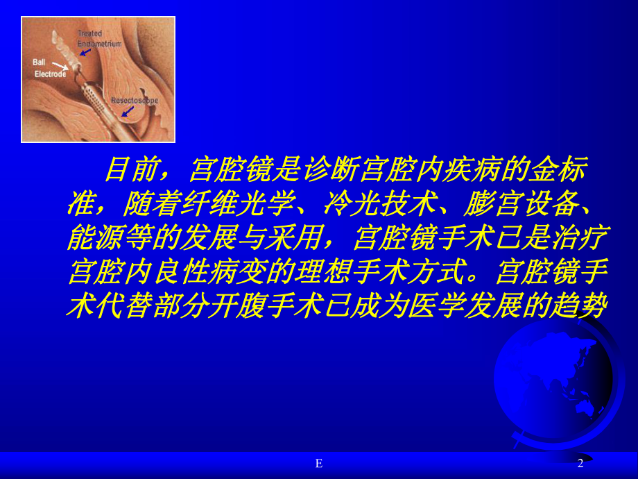 宫腔镜治疗宫腔疾病的进展PPT医学课件.ppt_第2页