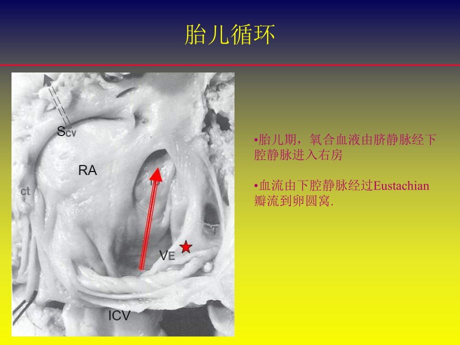 卵圆孔未闭封堵术：争论与发展(中英文)-精品课件.ppt_第2页