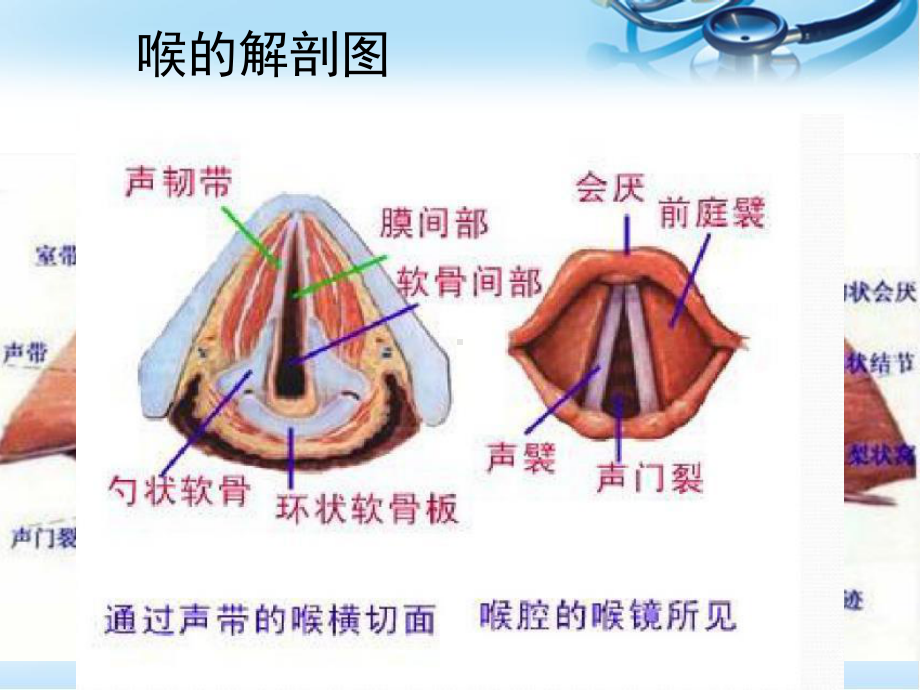 喉痉挛的处理ppt医学课件.ppt_第3页