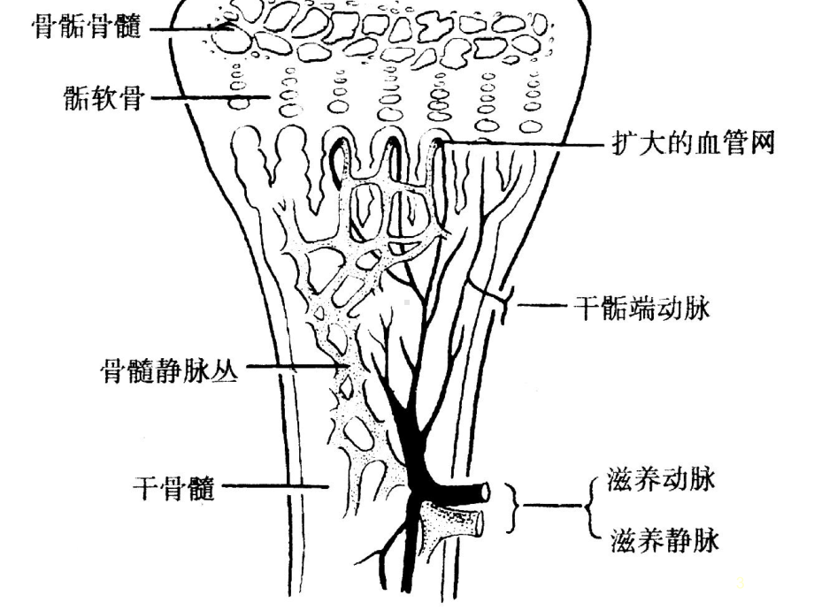 化脓性骨髓炎医学PPT课件.ppt_第3页