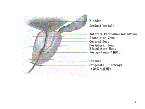 前列腺影像解剖PPT课件.ppt