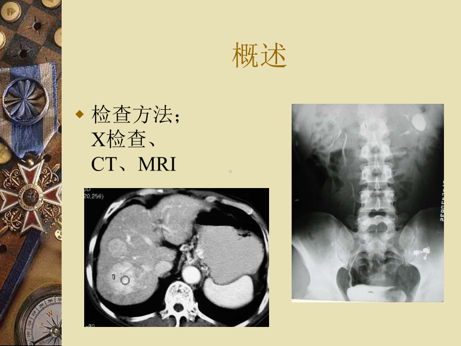 （医学课件）-腹部影像学.ppt_第3页