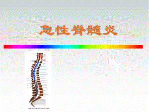 急性脊髓炎PPT医学课件.ppt