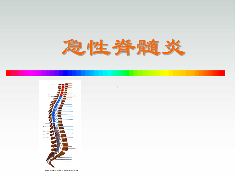 急性脊髓炎PPT医学课件.ppt_第1页