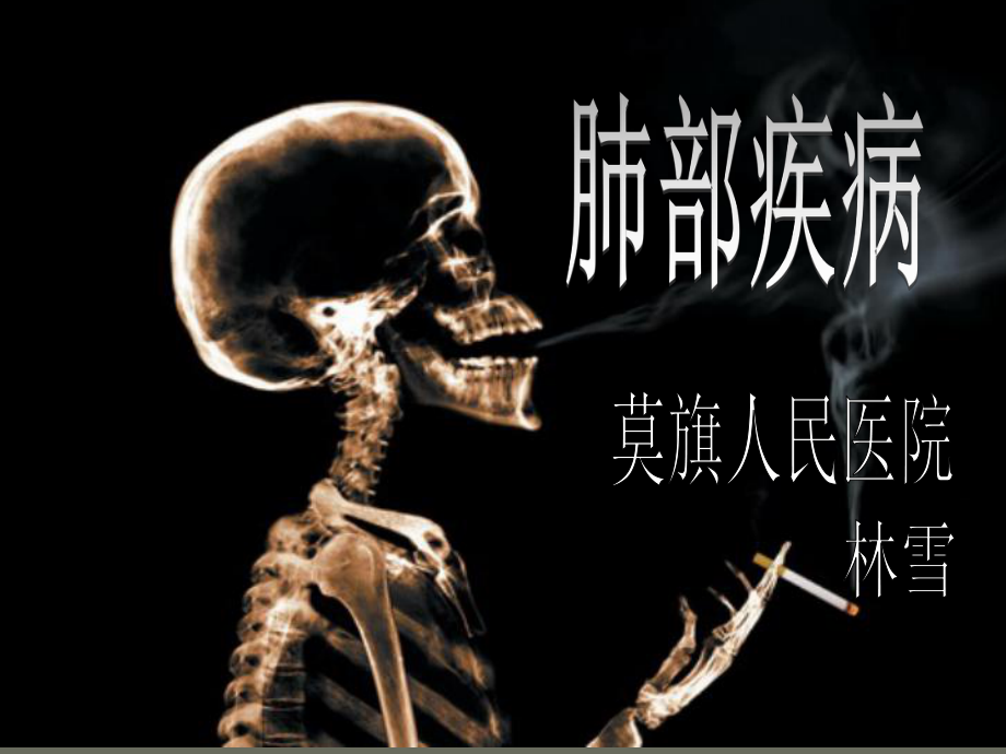 医学ppt-肺部疾病的x诊断课件.ppt_第1页