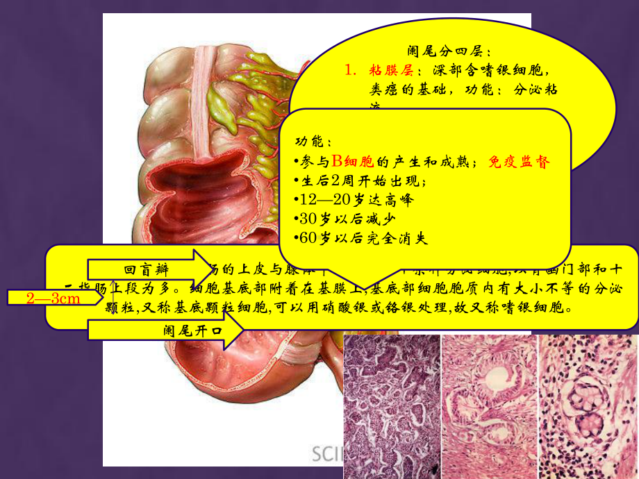 急性阑尾炎医学PPT课件.pptx_第3页