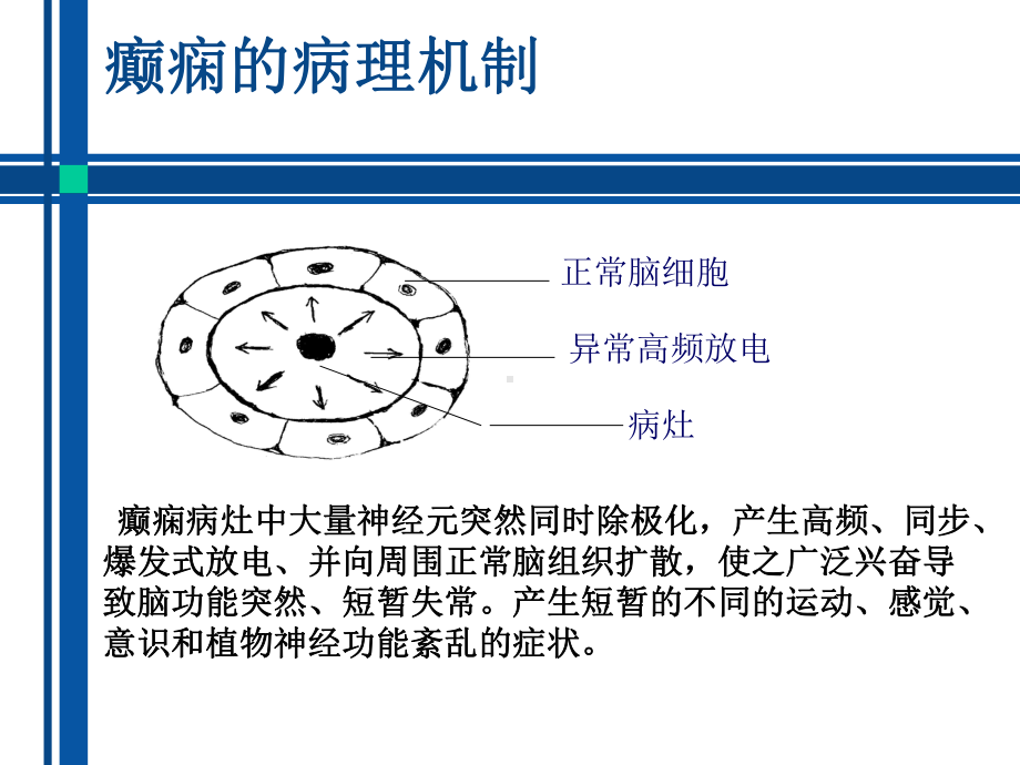 抗癫痫药物介绍-ppt课件.ppt_第3页