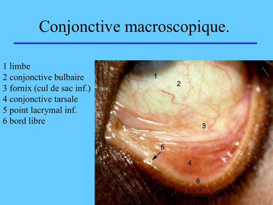 外教医学ppt课件--Maladies-de-la-conjonctive.shanghai.ppt_第3页