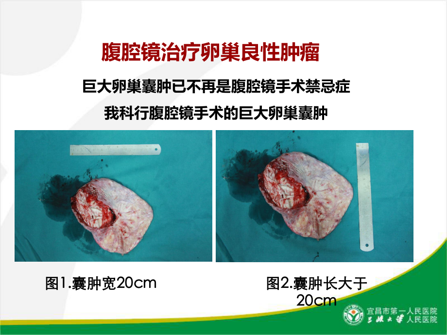 妇科腹腔镜现状思考与展望-共36页课件.ppt_第3页