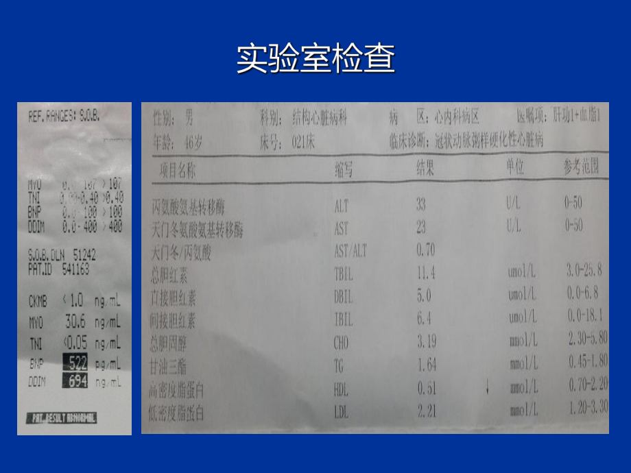 倍他乐克治疗缺血性心肌病课件.pptx_第3页