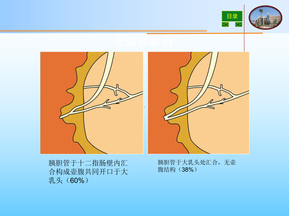 壶腹周围癌的影像诊断最新课件.ppt_第3页