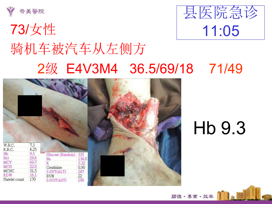 智慧医院案例-跨院际团队协作团队形塑未来式急重症医疗-软体流程与硬体建设课件.pptx_第2页