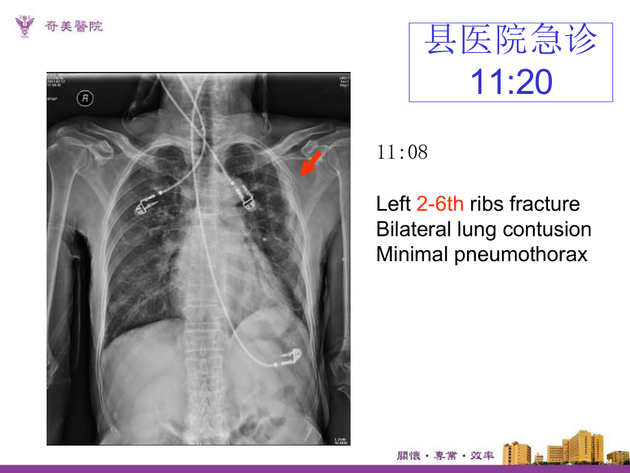 智慧医院案例-跨院际团队协作团队形塑未来式急重症医疗-软体流程与硬体建设课件.pptx_第3页