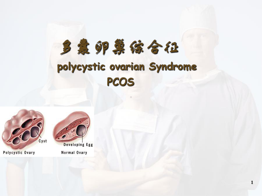 多囊卵巢综合征PPT医学ppt课件.ppt_第1页