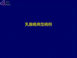 乳腺癌典型病例讨论一例.(ppt文档)课件.ppt