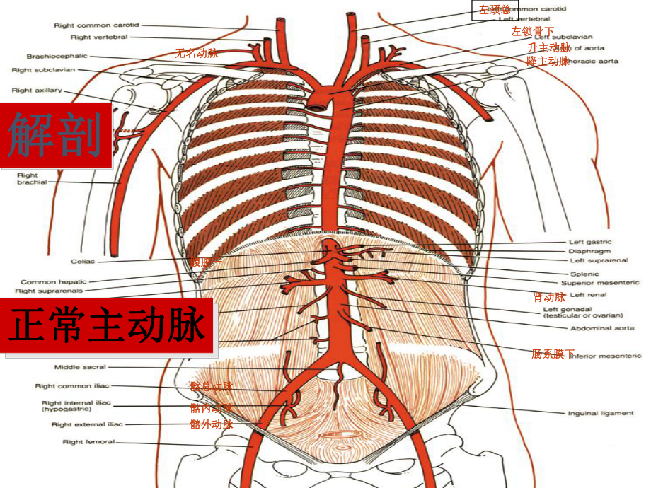 主动脉夹层的介入治疗与护理医学PPT课件.ppt_第3页