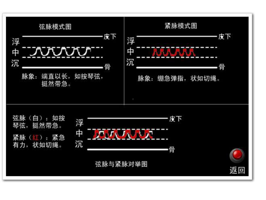 脉象示意图大全(黑图集)(医学PPT课件).ppt_第3页