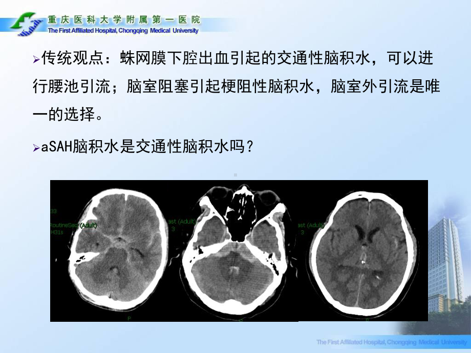 腰池引流：aSAH相关性脑积水的治疗课件.ppt_第3页