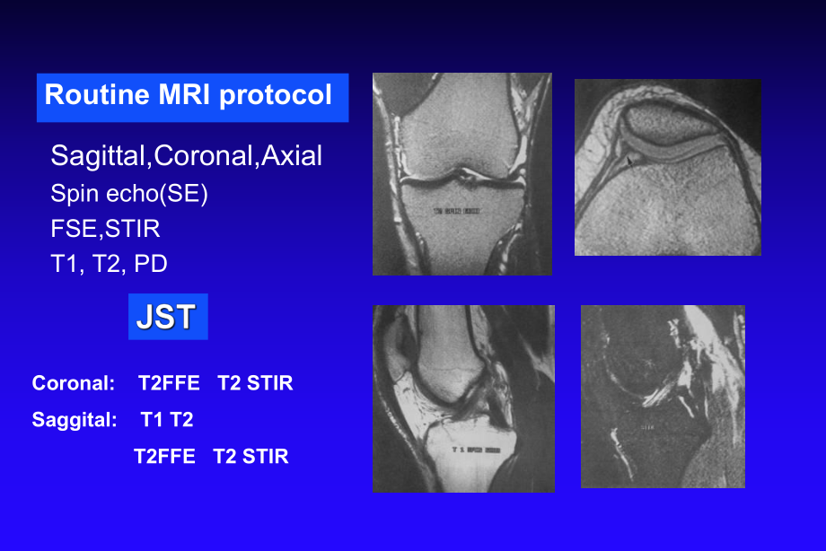 积水潭膝关节MRI-课件.ppt_第2页