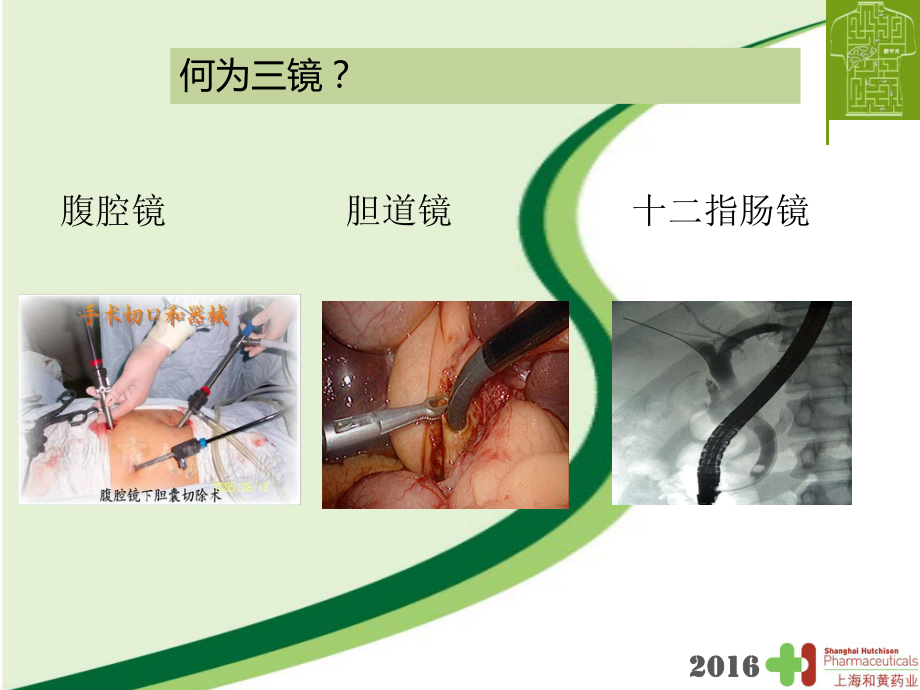 (完整版)三镜联合治疗胆石症课件.ppt_第3页