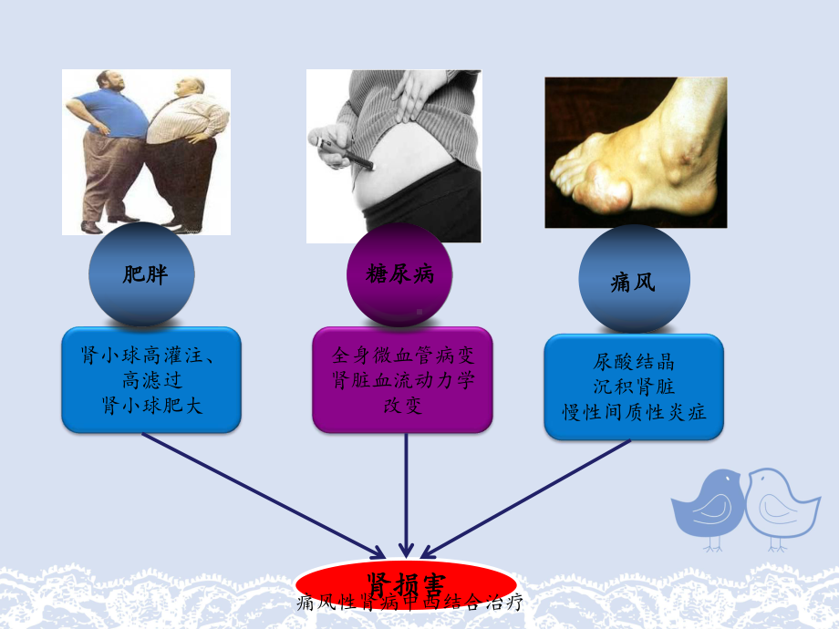 痛风性肾病中西结合治疗课件.ppt_第3页