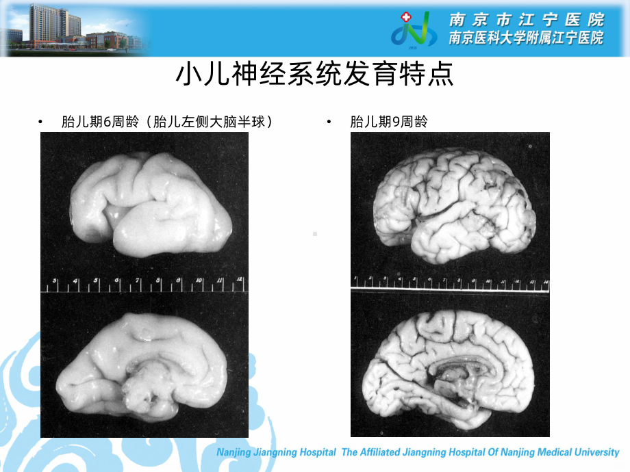 热性惊厥小讲座PPT课件.ppt_第3页