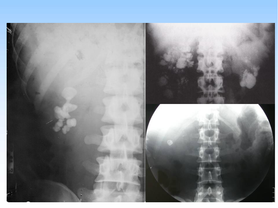 泌尿系统异常影像表现医学PPT课件.ppt_第2页