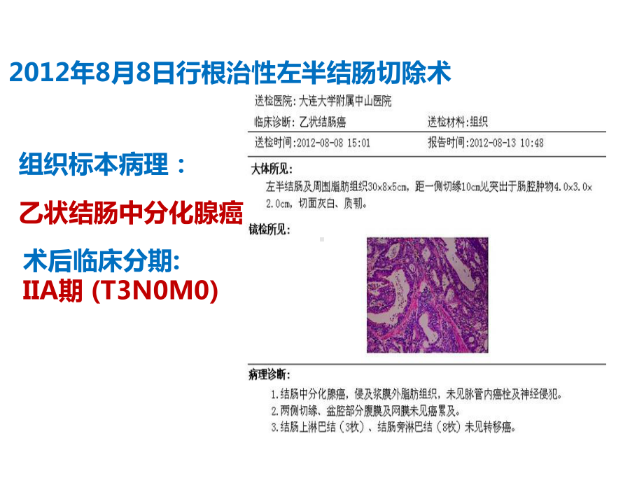 病理证实微粒-TACE治疗结肠癌肝转移完全缓解1例课件.pptx_第3页