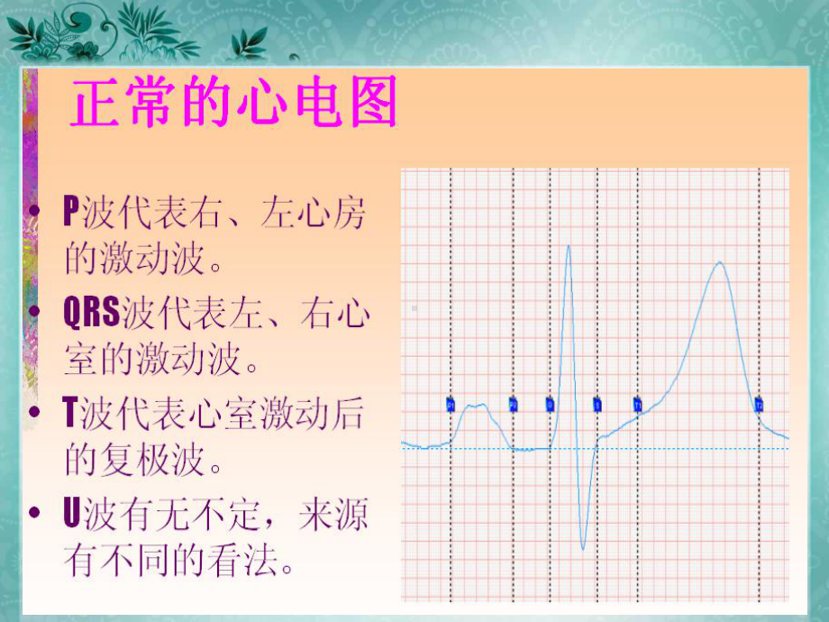 看心电图修改0829课件.ppt_第2页