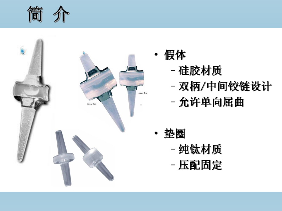 人工小关节置换要点课件.ppt_第3页