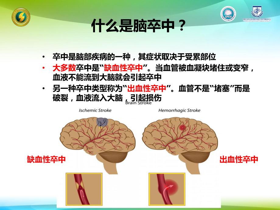 健康教育课堂的项目神经内科患者健康教育-PPT课件.ppt_第3页