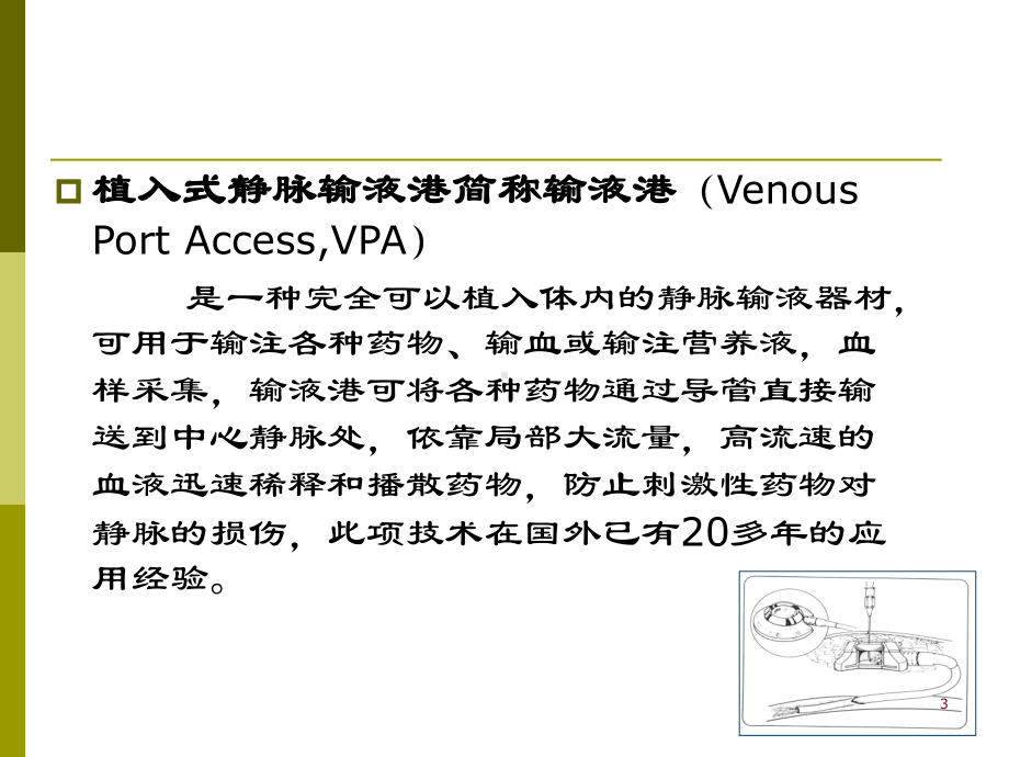 植入式静脉输液港幻灯片课件.ppt_第3页