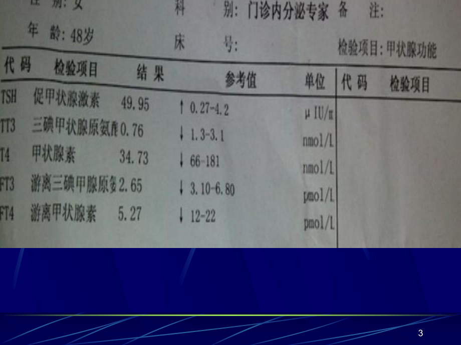 甲状腺功能检查及意义PPT参考课件.ppt_第3页