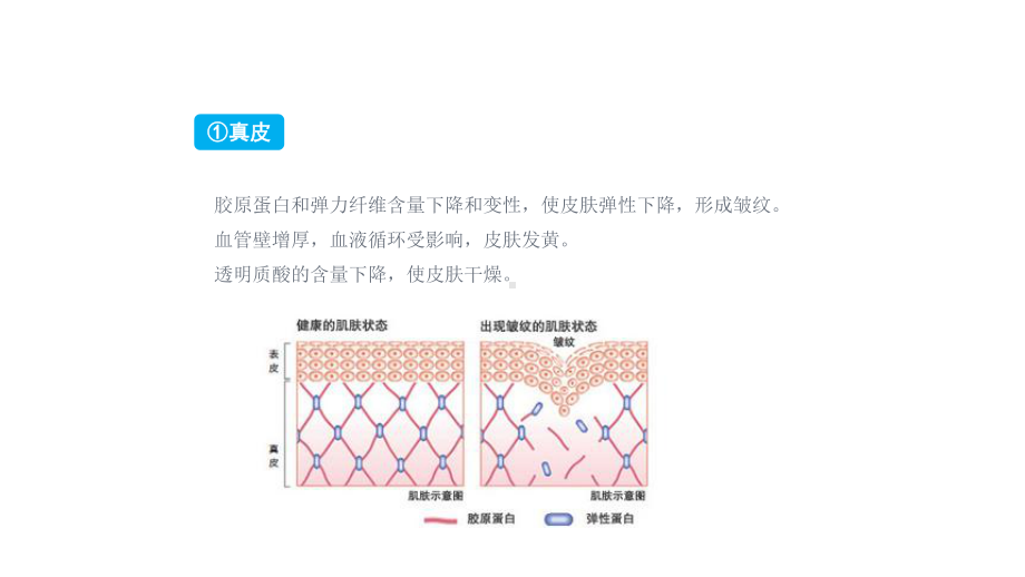 皮肤管理痘痘肌肤医学PPT课件.pptx_第3页