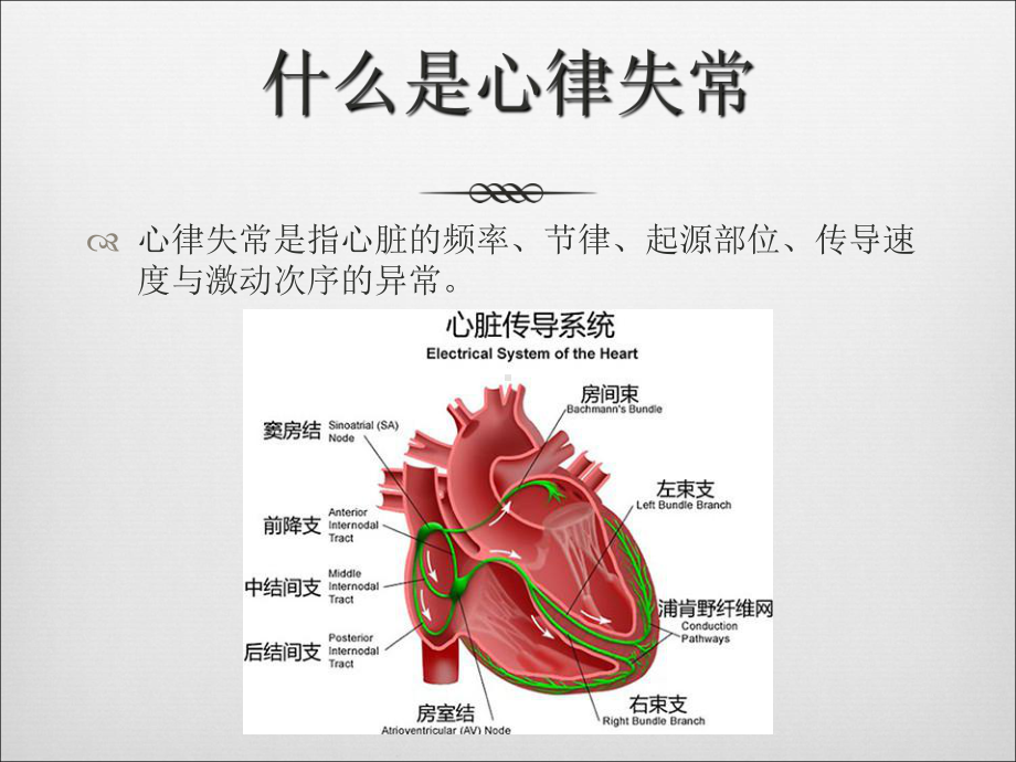 儿童常见心律失常的诊治ppt课件-PPT课件.ppt_第2页