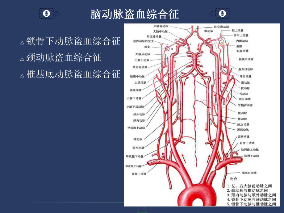 椎基底动脉系统及其综合征PPT参考课件.ppt_第3页