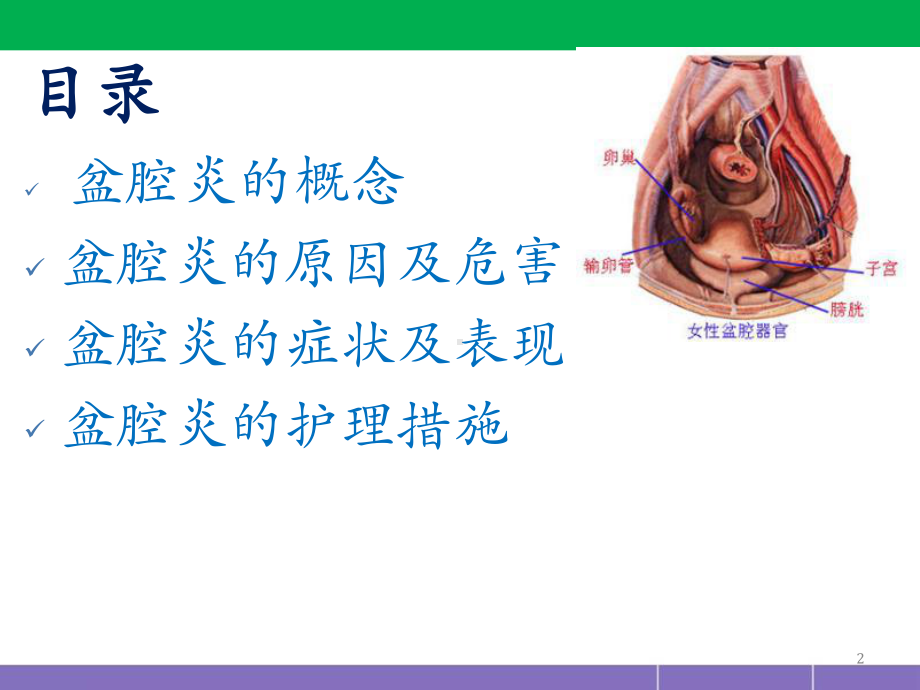 盆腔炎护理措施(妇产科)PPT医学课件.ppt_第2页