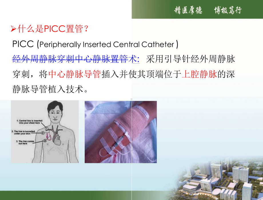 PICC置管定位课件.pptx_第3页