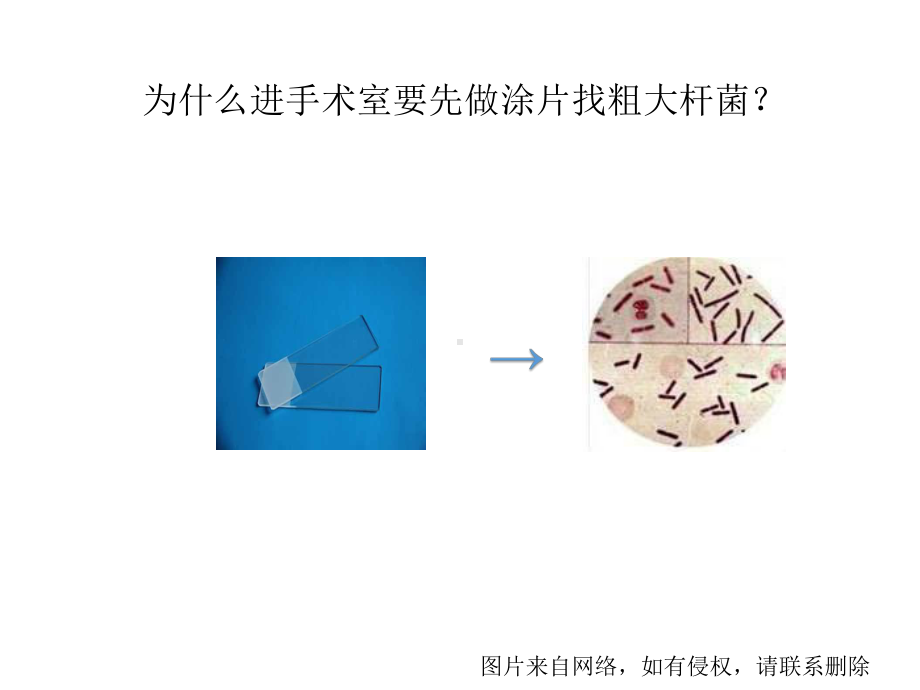 产气荚膜梭菌-PPT课件.ppt_第3页