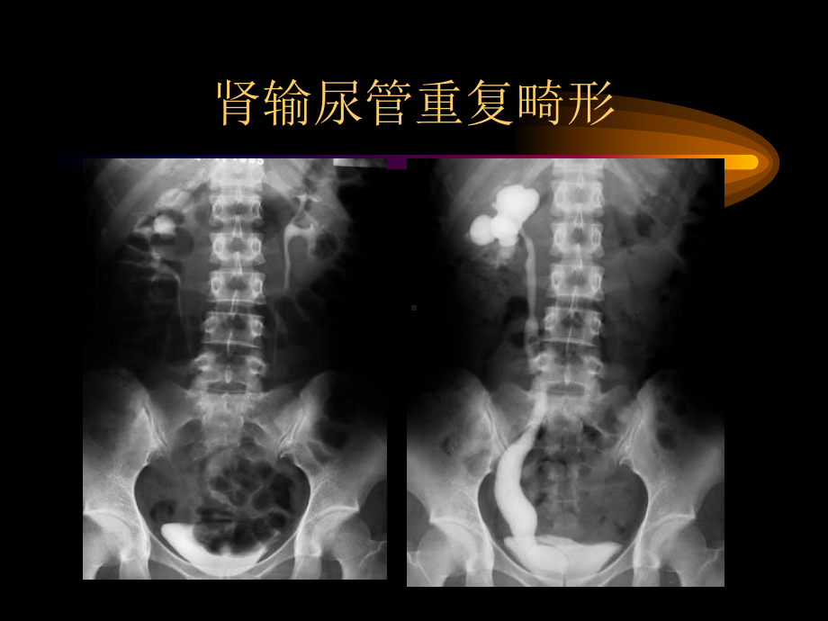 泌尿生殖图库1课件.ppt_第2页