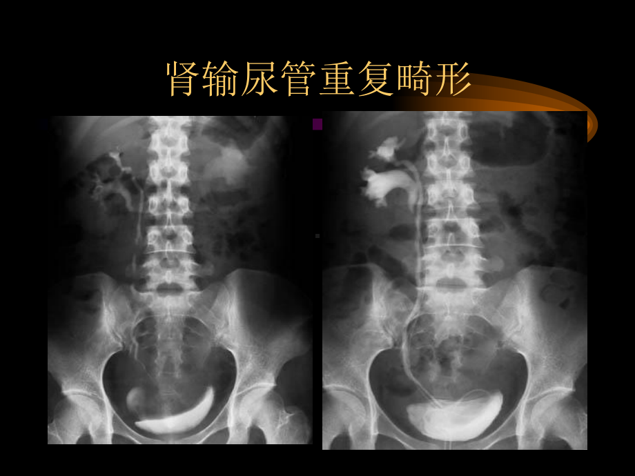 泌尿生殖图库1课件.ppt_第3页