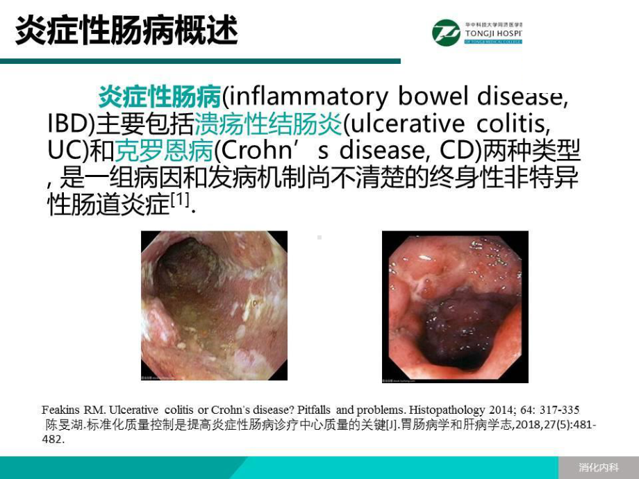 炎症性肠病患者延续性护理教育的研究课件.pptx_第3页