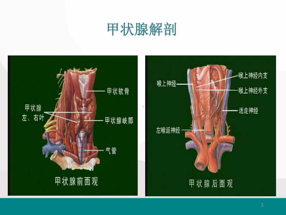 甲状腺次全切除术手术配合医学PPT课件.ppt_第3页