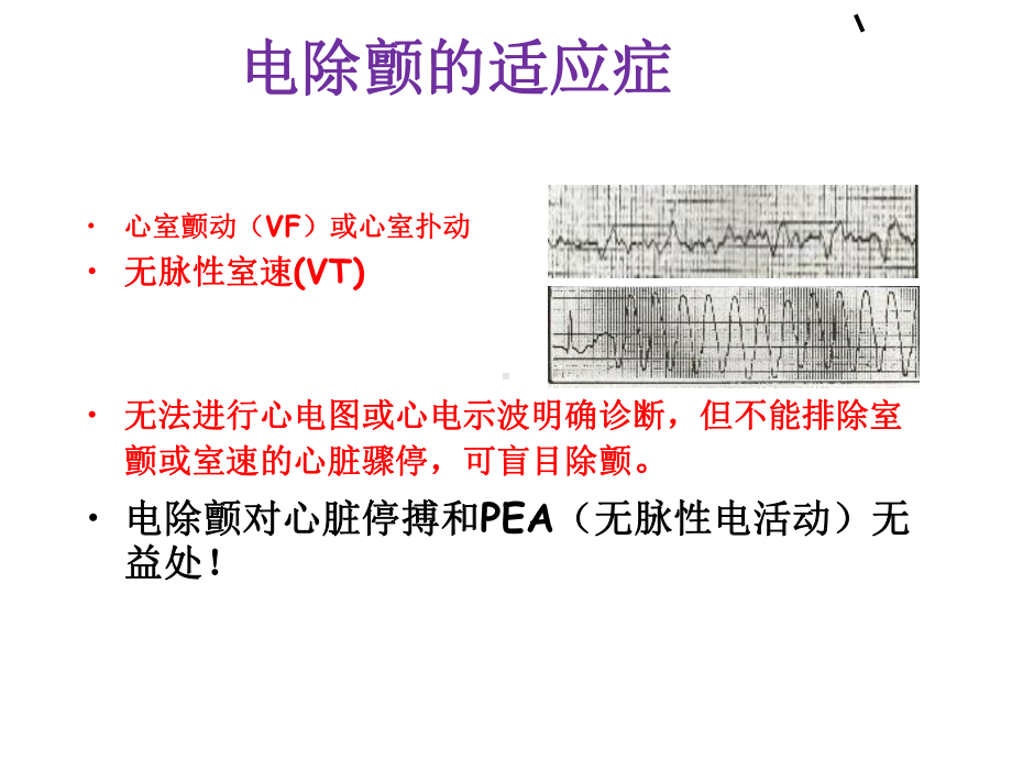 电除颤技术-PPT课件.ppt_第3页