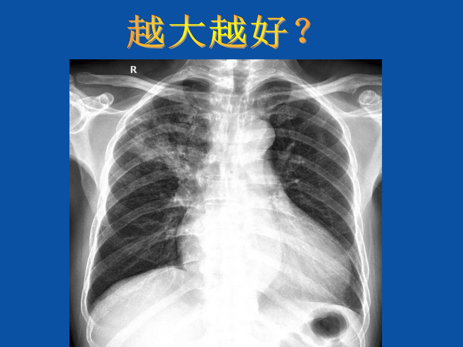 缩小才是硬道理-课件.ppt_第3页